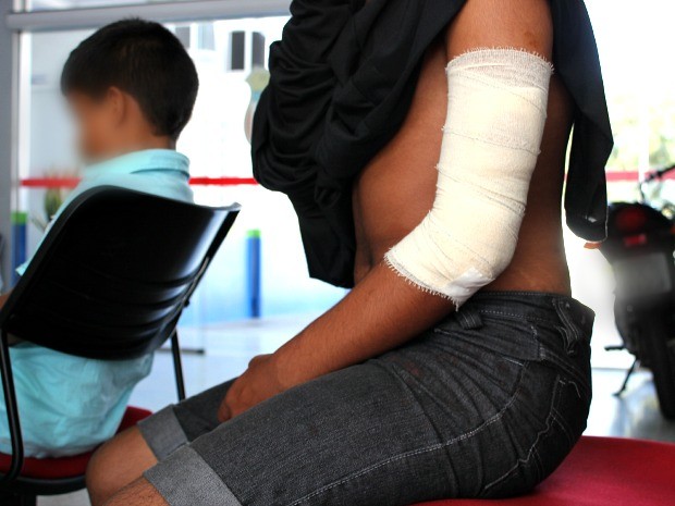 Paulo Henrique teve o braço esquerdo cortado com um terçado (Foto: Girlene Medeiros/G1 AM)