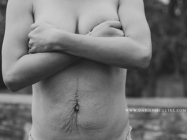 Marcas e flacidez não incomodam mulher, que posou para fotógrafa (Foto: Darien McGuire/Divulgação)