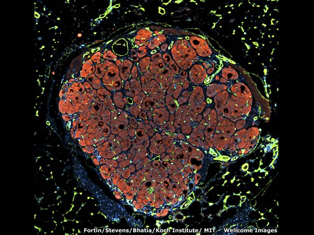 Este pequeno pedaço de um fígado humano foi colocado em um camundongo que tinha um problema no fígado. O fígado humano começou a crescer com a ajuda do sangue do camundongo (Foto: Chelsea Fortin, Kelly Stevens e Sangeeta Bhatia, Koch Institute, MIT)