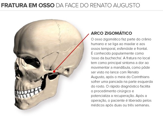 info fratura Rento Augusto (Foto: arte esporte)