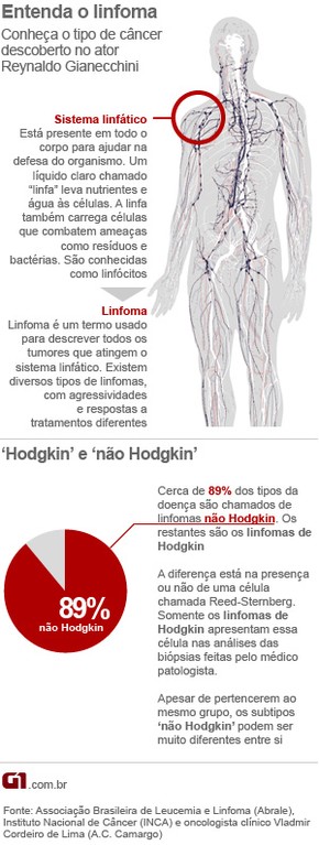 Cancer nao hodgkin sintomas - Hpv can cause cervical cancer, Cancer nao hodgkin sintomas