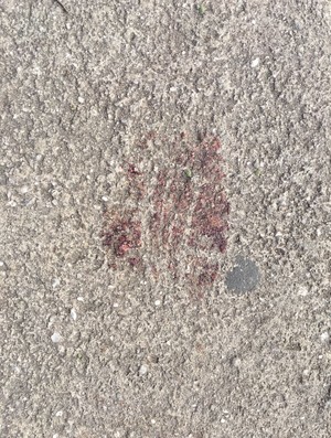 sangue torcedor fluminense agredido (Foto: Caio Costa / GloboEsporte.com)