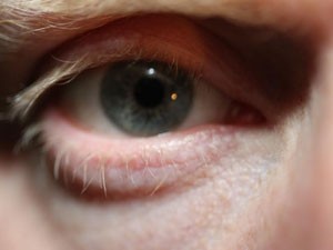 Movimento dos olhos pode indicar esquizofrenia, diz estudo (Foto: BBC)