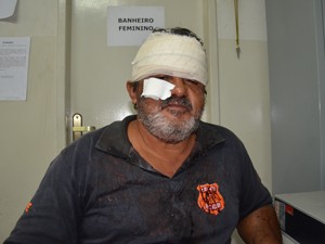 Agente ficou ferido no rosto após murro (Foto: Walter Paparazzo/G1)