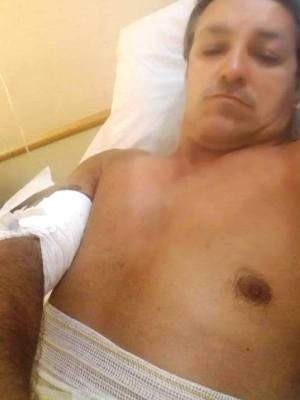 Renato teve fraturas nas costas após acidente (Foto: Arquivo Pessoal)