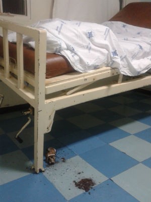 Pé da cama do Hospital Beneficência Portuguesa em Araraquara está esfarelando (Foto: Ana Regina Orloski)