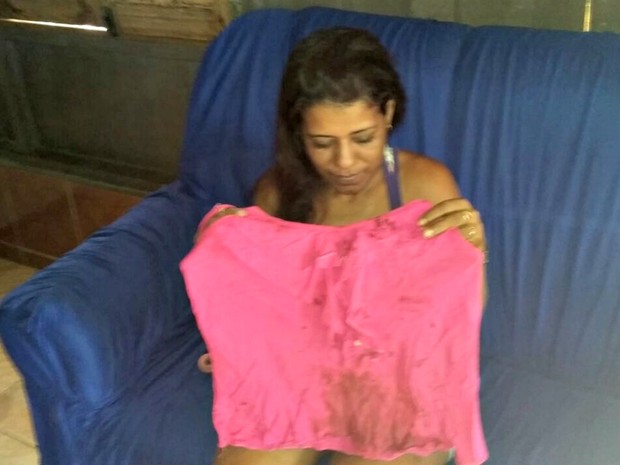 Francisca Magna mostra as marcas de sangue que ficaram em sua camisa  (Foto: Adelcimar Carvalho/G1)