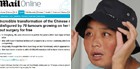 Chinesa com 70 tumores ganha novo rosto (Reprodução/Daily Mail)