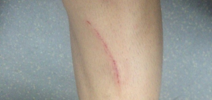 Petros reclama lance do gol do Ituano e mostra perna machucada em foto