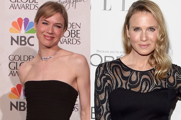 Renée Zellweger era uma das atrizes mais queridas de Hollywood e ficou irreconhecível nos últimos anos (Foto: Getty Images)