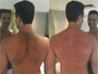 Iran Malfitano depila as costas com cera quente e diz: 'Dói demais, não dá'
