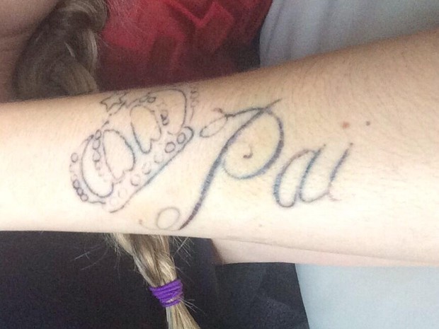Bárbara Evans mostra tatuagem sendo removida (Foto: Twitter / Reprodução)