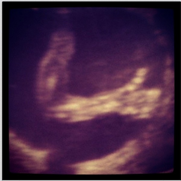 Ana Hickmann posta foto do ultrassom de Alexandre (Foto: Reprodução/Instagram)