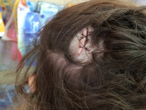 Criança levou dois pontos na cabeça por causa de mordida de cão (Foto: Talita Caroline de Oliveira Telles Ferraz Ferreira/VC no G1)