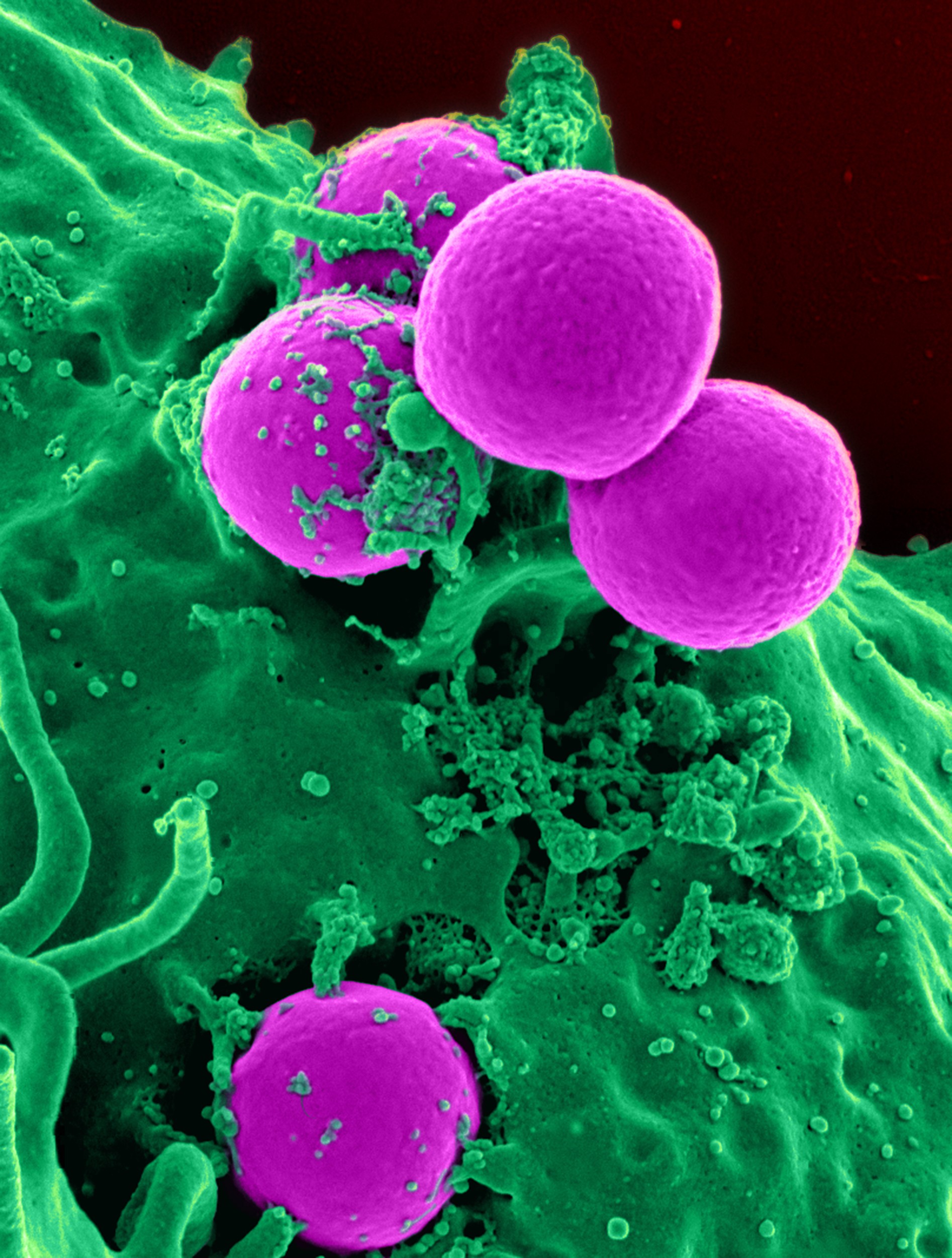 Staphylococcus aureus, bactéria que causa infecções na pele e é resistente a vários tipos de antibióticos  (Foto: Wikimedia Commons)