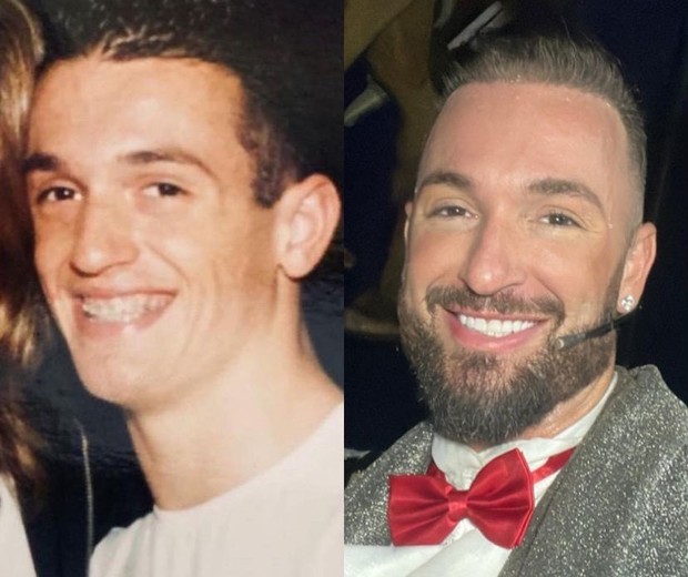 Diego Hypolito antes e depois de seus procedimentos estéticos (Foto: Reprodução/ Instagram) Diego Hypolito antes e depois de seus procedimentos estéticos (Foto: Reprodução/ Instagram)