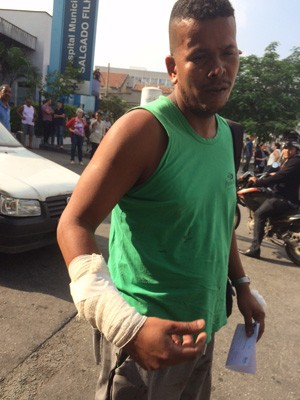 Wagner Faria Siqueira, de 36 anos, ferido por estilhaços no braço direito durante troca de tiros. (Foto: Henrique Coelho/ G1)