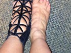Kim Kardashian mostra pés inchados após usar sapato