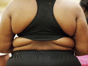 #obesidade (Foto: Finbarr O'Reilly/Reuters)