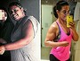 Mulher perde 41 kg com exercícios e dieta ao ter cirurgia negada por plano