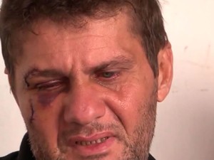 Pai do garoto morto após ser espancado em assalto na Bahia tem hematomas (Foto: Reprodução/ TV Santa Cruz) Pai do garoto morto após ser espancado em assalto na Bahia tem hematomas (Foto: Reprodução/ TV Santa Cruz)