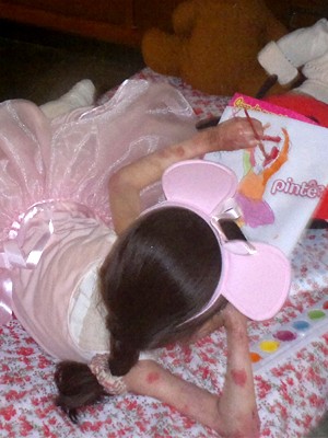 Letícia, de 7 anos, tem epidermólise bolhosa (Foto: Arquivo Pessoal)