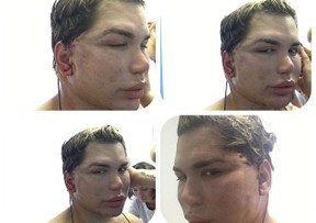 Ego Rodrigo Alves O Ken Humano Refaz O Rosto E Admite Nao Aceito Envelhecer Noticias De Famosos