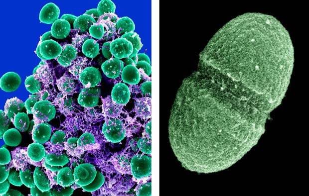  À esquerda, imagem de bactérias Staphylococcus epidermidis, em verde, feitas com microscópio eletrônico; à direita, a bactéria Enterococcus faecalis, que vive no aparelho digstino humano; os dois organismos são alguns dos estudados pelo projeto (Foto: AP)