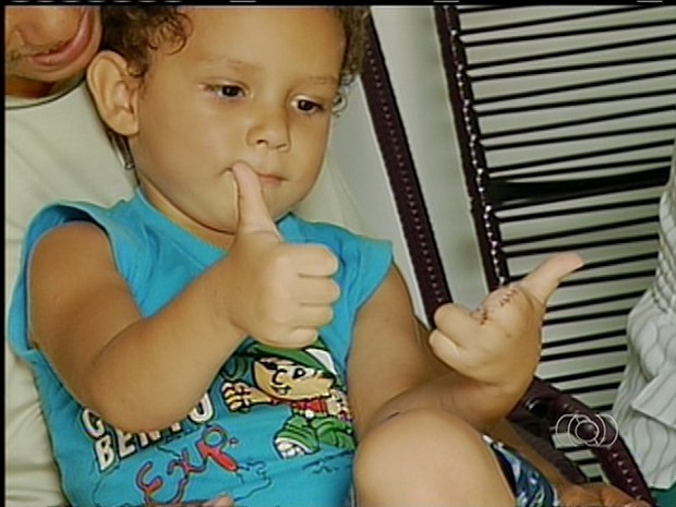 Pais dizem que menino não perdeu a alegria, apesar de não ter mais dois dedos da mão esquerda (Foto: Reprodução/TV Anhanguera)