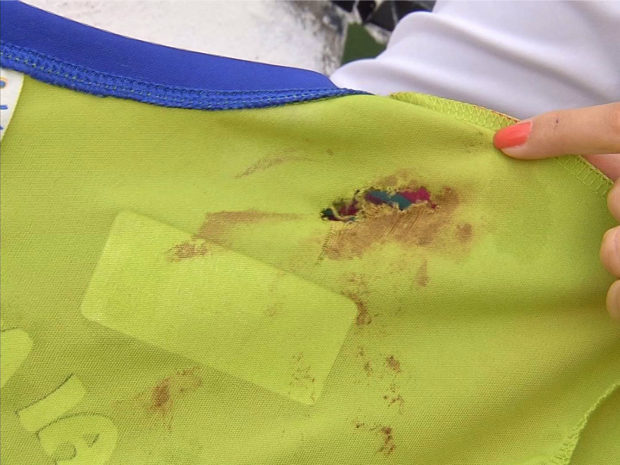 Roupa que Ígor usava quando foi baleado foi perfurada e ficou manchada de sangue (Foto: TV Verdes Mares/Reprodução)