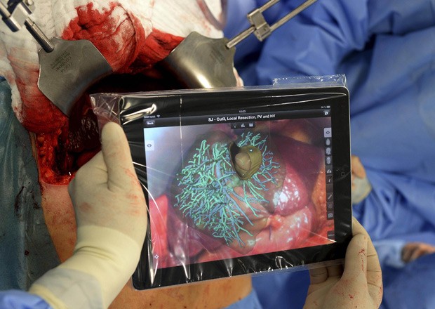 Equipe utiliza tablet para visualizar com mais precisão estruturas do fígado durante cirurgia. (Foto: Reuters/Fabian Bimmer )