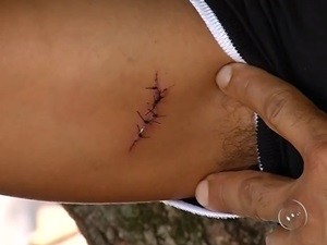 Servidor levou uma facada no braço durante a confusão. Rio Preto (Foto: Reprodução/TV TEM)