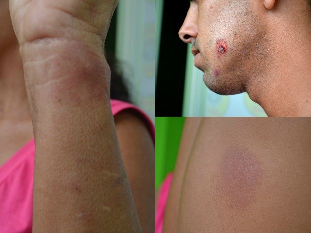 Vítimas ficaram com vários ferimentos após assalto na noite de terça-feira (10) (Foto: Aline Nascimento/G1)