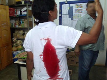 Professora foi atacada dentro da sala de aula, quando virou para fechar a porta. (Foto: Arquivo Pessoal)