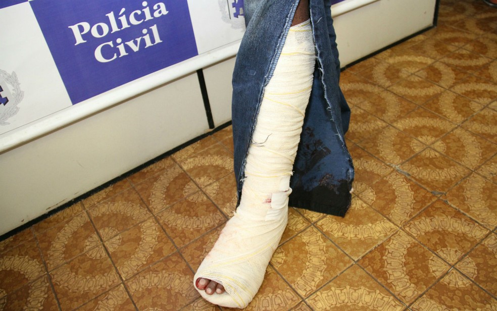 O suspeito foi baleado no pé durante ação (Foto: Divulgação/Polícia Civil)
