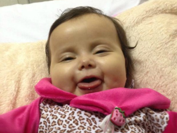 Sofia de cinco meses sofre da síndrome de Berdon (Foto: Jéssica Pimentel / G1)