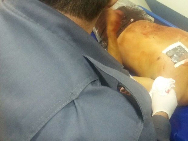 Homem foi ferido no peito e socorrido por militares do Corpo de Bombeiros (Foto: Corpo de Bombeiros/Divulgação)