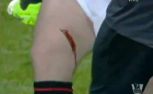 Corte na perna de Rooney após entrada de Rodallega (Foto: Reprodução / FA)