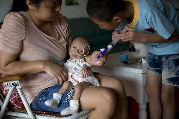 Wu Lunjiao (esq.) segura sua filha, Yuanyuan, enquanto o filho bombeia leite para o estômago da menina, na casa da família em Shenzhen, China (Foto: Reuters/Stringer)