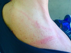 Atriz Relata Assalto Com Agressao No Leblon Rj Da Vontade De Morar Fora Rio De Janeiro G1 Arranhoes ja nao tira mais as dores do meu coracao, todo dia eu vejo sangue ja e rotina, criticas nem se fala ne? g1 globo