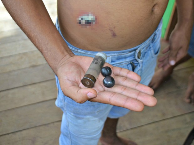 Sete pessoas foram atingidas por balas de borracha que teriam sido disparadas por policiais militares (Foto: Adelcimar Carvalho/G1)