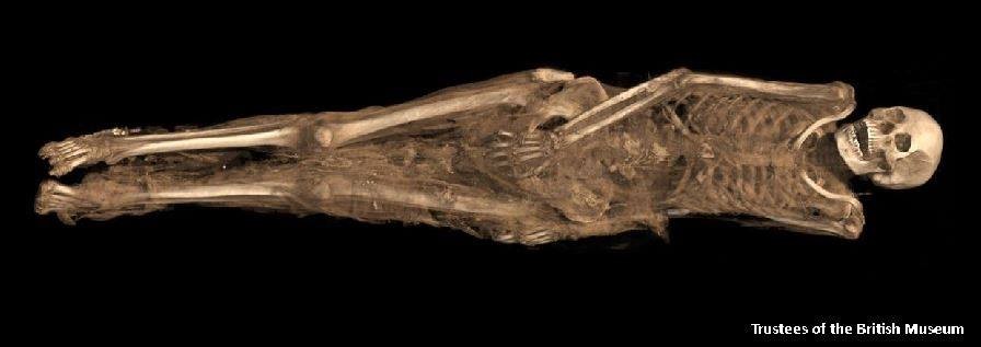 Testes revelaram detalhes dos ossos e da pele das múmias egípicas (Foto: Trustees of the British Museum/BBC)