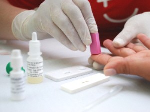 testes gratuitos de hiv em ubatuba (Foto: Divulgação)