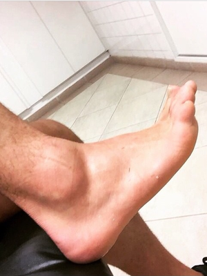 Alexandre Pato tornozelo (Foto: Reprodução/ Instagram)