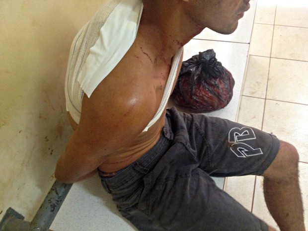 Assaltante foi baleado enquanto tentava assaltar a casa dos dois irmãos  (Foto: Aline Nascimento/G1)