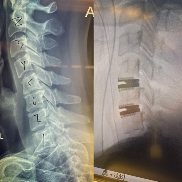 Katherine Heigl passa por cirurgia (Foto: Reprodução/Instagram)