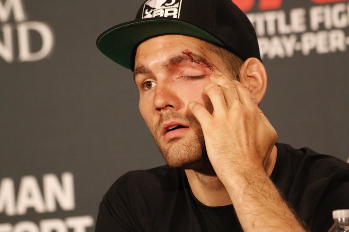 Chris Weidman UFC 187 coletiva de imprensa (Foto: Evelyn Rodrigues)