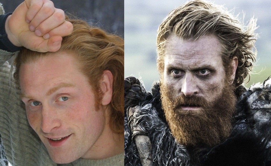 Veja o antes e depois do elenco de 'Game of Thrones' - Revista Galileu