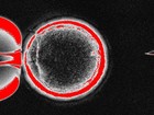 Cientistas criam células-tronco humanas por meio de clonagem