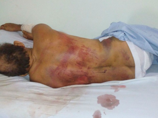Idoso foi espancado no município de Quijingue, na Bahia (Foto: Site Notícias de Santaluz)